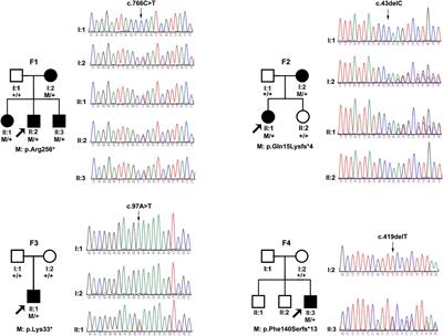 Novel BMP4 Truncations Resulted in Opposite Ocular Anomalies: Pathologic Myopia Rather Than Microphthalmia